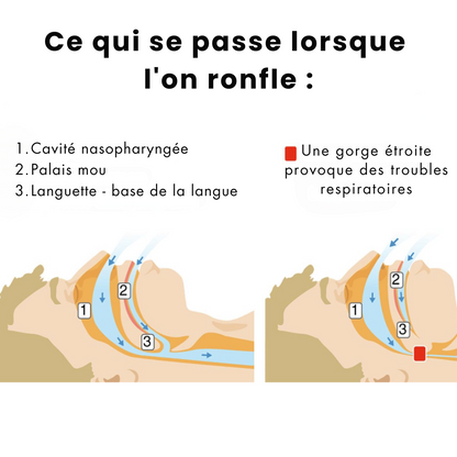 Zenlo - Pour une nuit sans ronfement